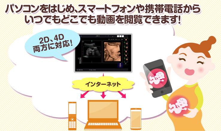 エンジェル メモリーの特徴